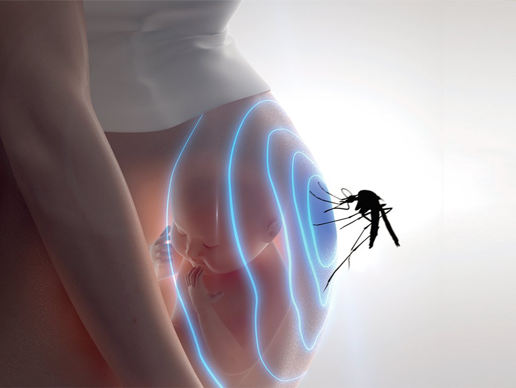 Zika podría causar abortos en mujeres que no presenten síntomas