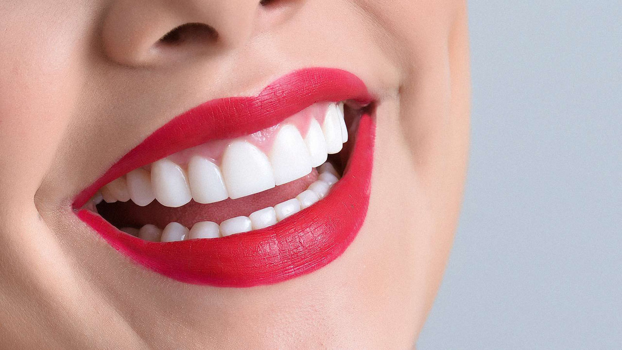 Existe una gran variedad de tratamientos "caseros" que pueden perjudicar tu dentadura, reconócelos