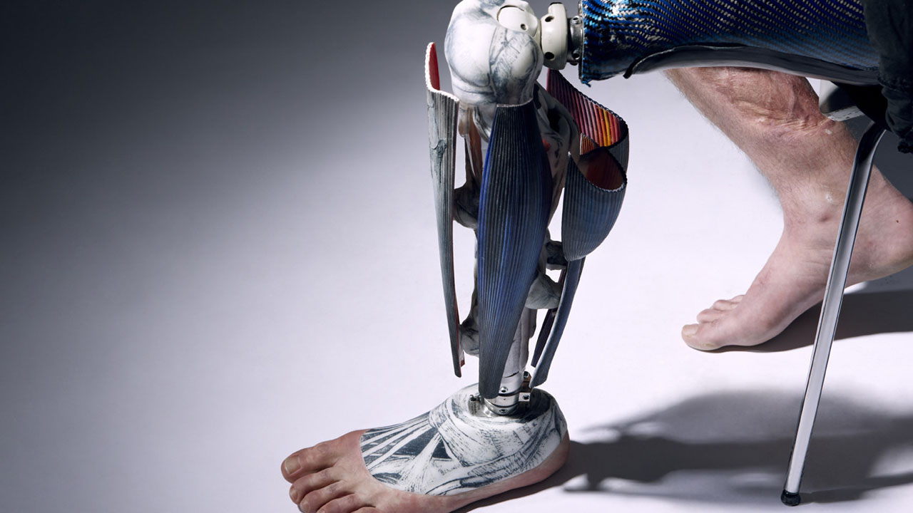 Toyota alquilará protesis