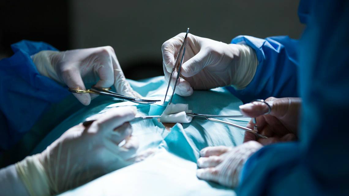 Simon Bramhall de 53 años marcó los hígados de dos pacientes con una sonda de coagulación por plasma de argón que se utiliza en cirugía para detener las hemorragias