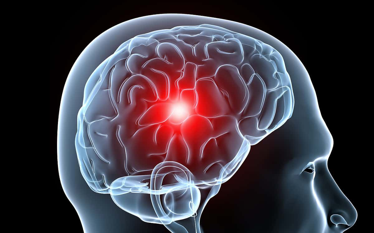 Los investigadores encontraron que este intenso dolor de cabeza está asociado con ataque cardíaco, accidente cerebrovascular, coágulos de sangre y frecuencia cardíaca irregular