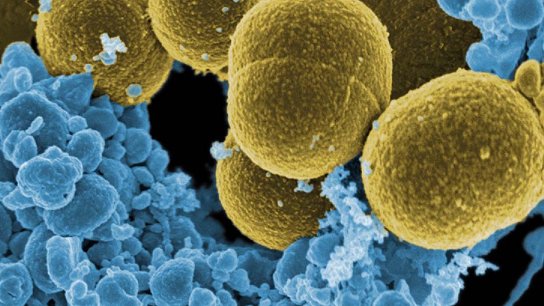 Doble Llave - Evolución de las bacterias sigue un "patrón común"