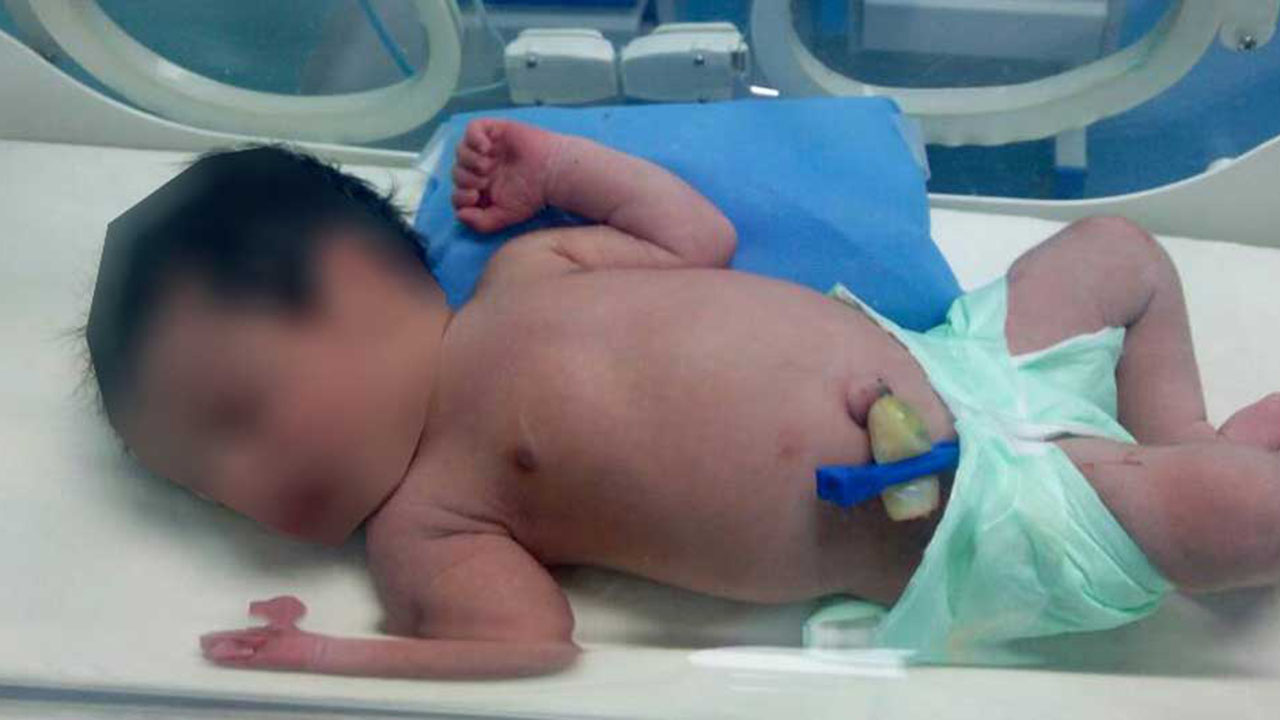 Se presume que el infante tenía pocas horas de nacido pues todavía portaba el cordón umbilical