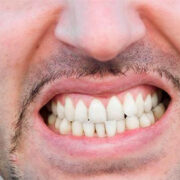 Manejo del Bruxismo: Soluciones frente al hábito de apretar o rechinar los dientes
