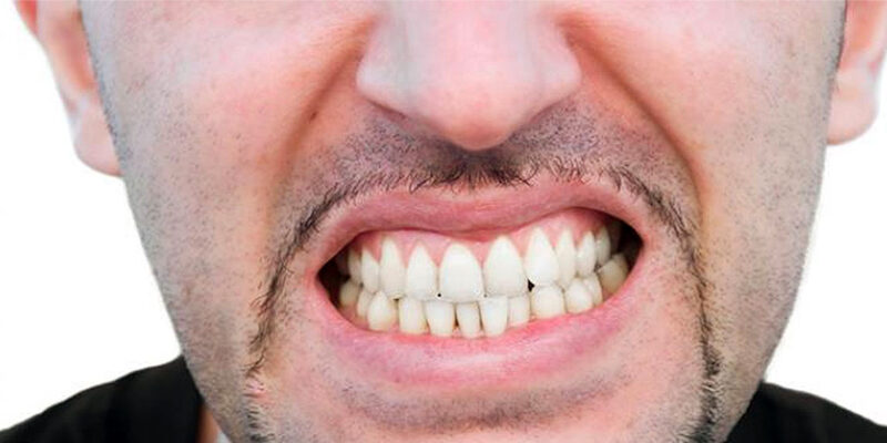 Manejo del Bruxismo: Soluciones frente al hábito de apretar o rechinar los dientes