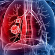 Investigadores lograron revivir varios pulmones