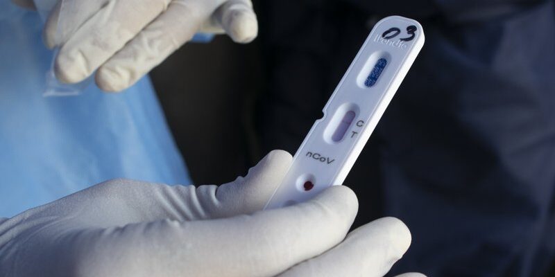 Sociedad de Infectología ve con preocupación la flexibilización en Carnavales