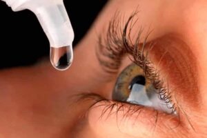 ¿Qué es el glaucoma y cómo tratarlo?
