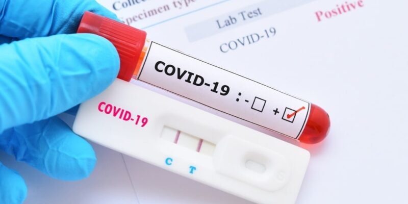Cierran un laboratorio británico tras detectar 43.000 tests de Covid-19 erróneos