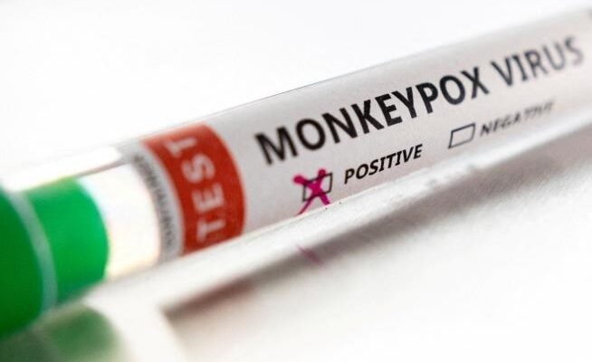 Monkeypox