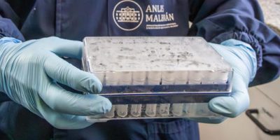Argentina - hantavirus