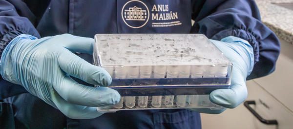 Argentina - hantavirus